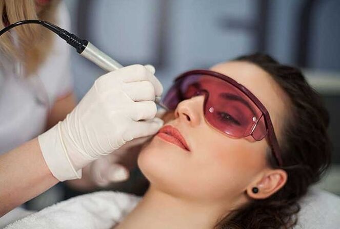 Laser Biarvitaliséierung