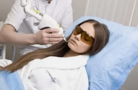 Fraktiouns Laser Verjéngung